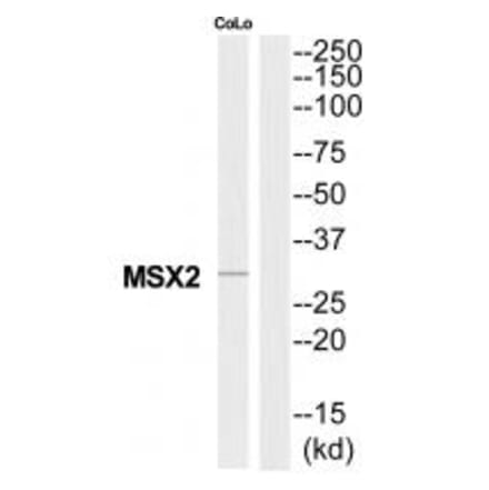 Western blot - MSX2 Antibody from Signalway Antibody (34744) - Antibodies.com