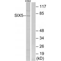 Western blot analysis of extracts from K562 cells, using SIX5 antibody #34747.