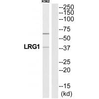 Western blot analysis of extracts from K562 cells, using A2GL antibody #34755.