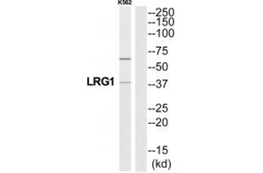 Western blot - A2GL Antibody from Signalway Antibody (34755) - Antibodies.com