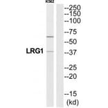 Western blot - A2GL Antibody from Signalway Antibody (34755) - Antibodies.com