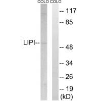 Western blot analysis of extracts from COLO cells, using LIPI antibody #34760.