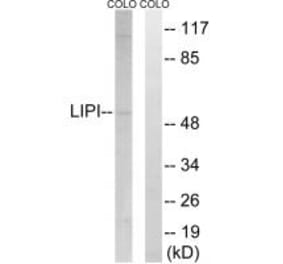 Western blot - LIPI Antibody from Signalway Antibody (34760) - Antibodies.com