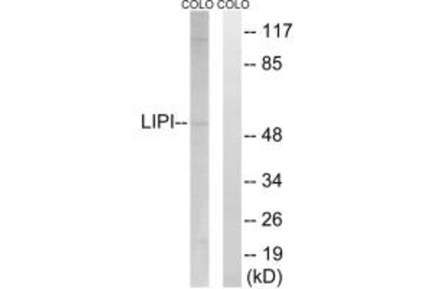 Western blot - LIPI Antibody from Signalway Antibody (34760) - Antibodies.com