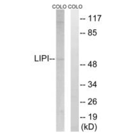 Western blot - LIPI Antibody from Signalway Antibody (34760) - Antibodies.com