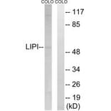 Western blot - LIPI Antibody from Signalway Antibody (34760) - Antibodies.com