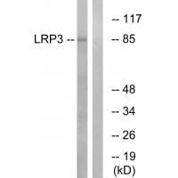 Western blot analysis of extracts from RAW264.7 cells, using LRP3 antibody #34768.