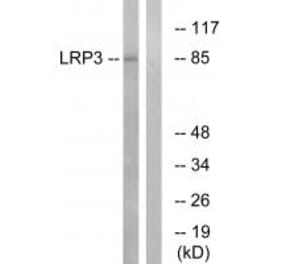 Western blot - LRP3 Antibody from Signalway Antibody (34768) - Antibodies.com