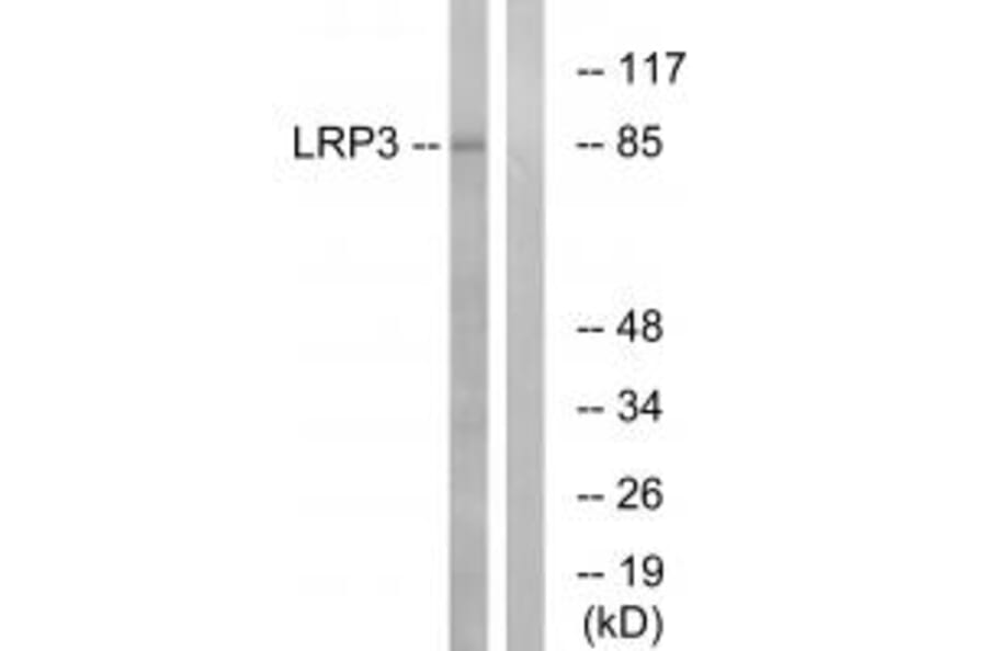 Western blot - LRP3 Antibody from Signalway Antibody (34768) - Antibodies.com