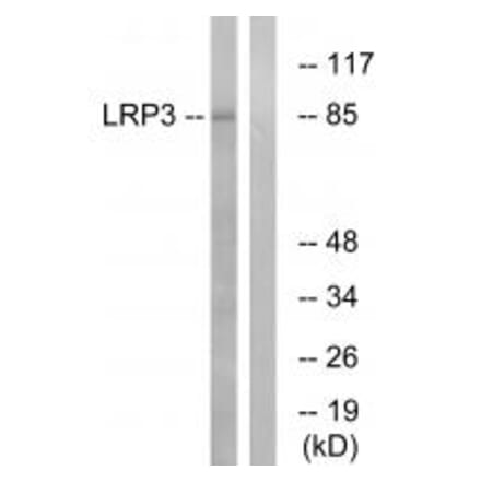 Western blot - LRP3 Antibody from Signalway Antibody (34768) - Antibodies.com