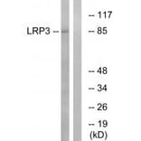 Western blot - LRP3 Antibody from Signalway Antibody (34768) - Antibodies.com