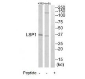 Western blot - LSP1 Antibody from Signalway Antibody (34771) - Antibodies.com