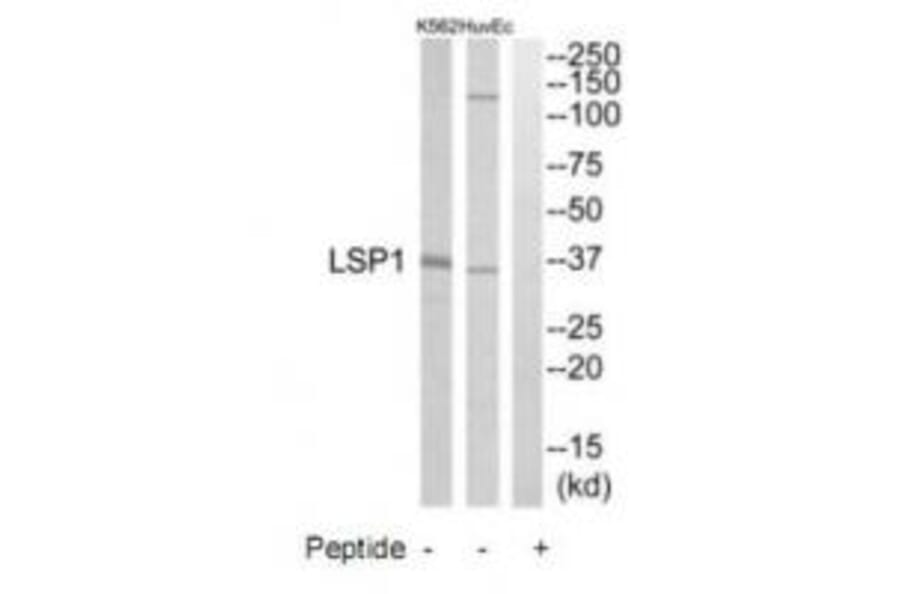 Western blot - LSP1 Antibody from Signalway Antibody (34771) - Antibodies.com