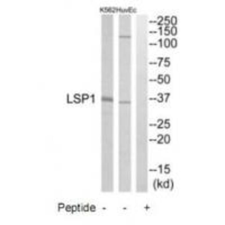 Western blot - LSP1 Antibody from Signalway Antibody (34771) - Antibodies.com