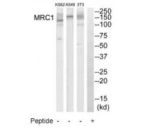 Western blot - MRC1 Antibody from Signalway Antibody (34773) - Antibodies.com