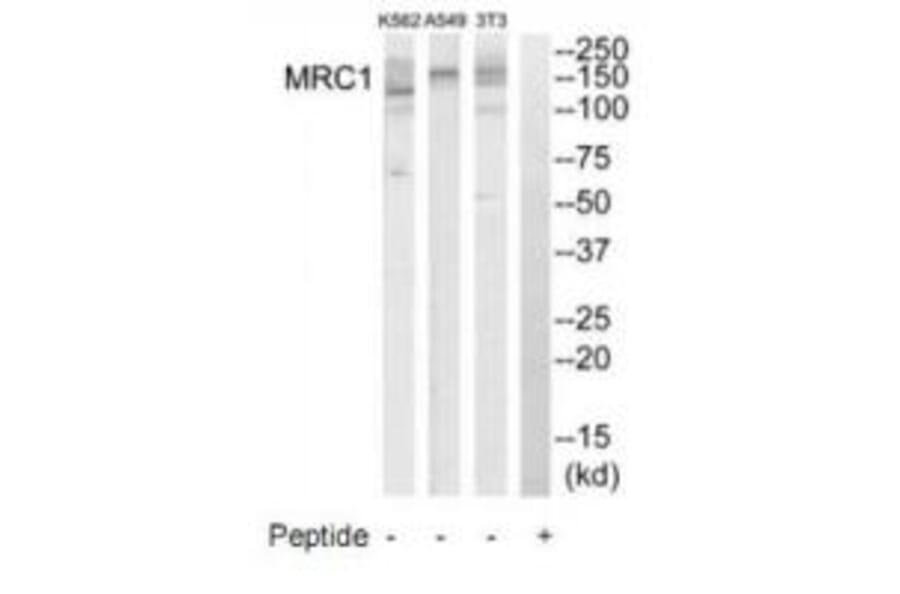 Western blot - MRC1 Antibody from Signalway Antibody (34773) - Antibodies.com