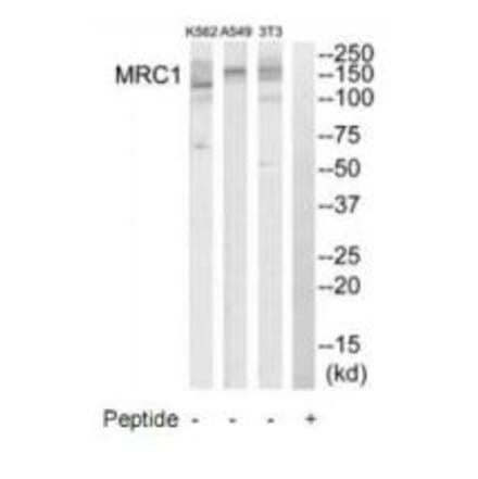 Western blot - MRC1 Antibody from Signalway Antibody (34773) - Antibodies.com