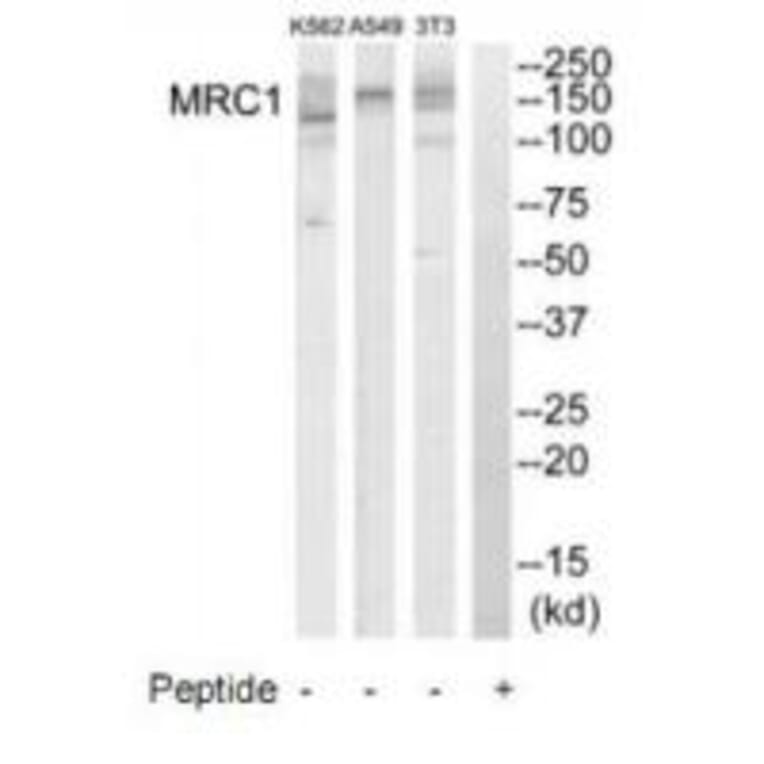 Western blot - MRC1 Antibody from Signalway Antibody (34773) - Antibodies.com