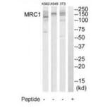 Western blot - MRC1 Antibody from Signalway Antibody (34773) - Antibodies.com