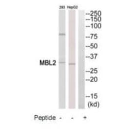 Western blot - MBL2 Antibody from Signalway Antibody (34776) - Antibodies.com