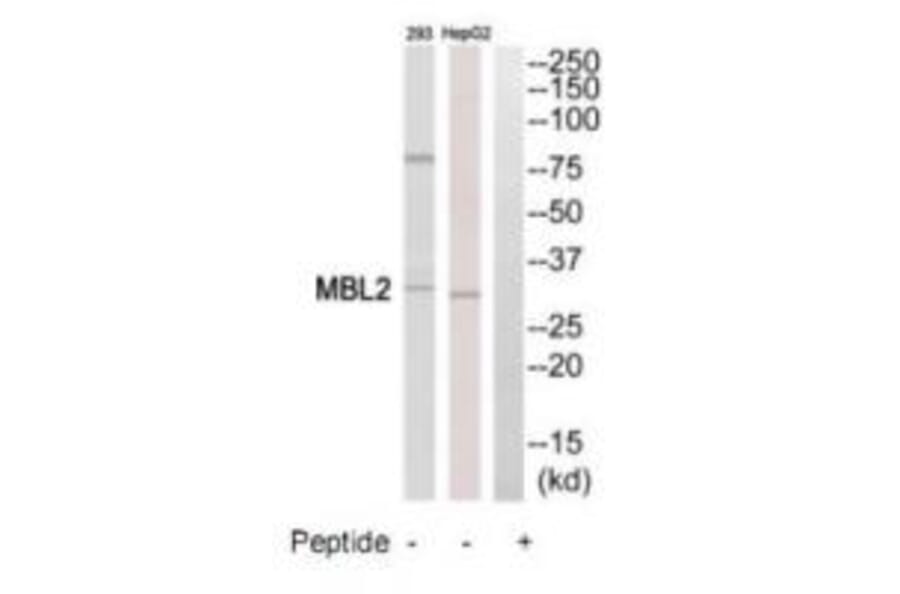 Western blot - MBL2 Antibody from Signalway Antibody (34776) - Antibodies.com