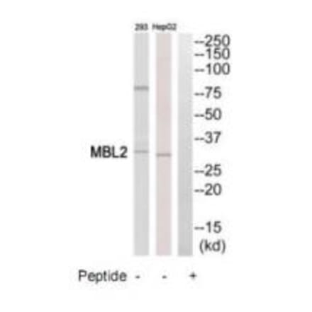 Western blot - MBL2 Antibody from Signalway Antibody (34776) - Antibodies.com
