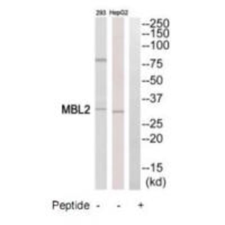 Western blot - MBL2 Antibody from Signalway Antibody (34776) - Antibodies.com