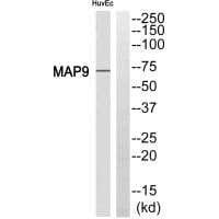 Western blot analysis of extracts from HuvEc cell, using MAP9 antibody #34789.