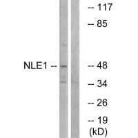 Western blot analysis of extracts from COS cells, using NLE1 antibody #34866.