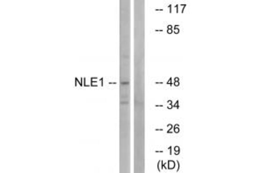 Western blot - NLE1 Antibody from Signalway Antibody (34866) - Antibodies.com