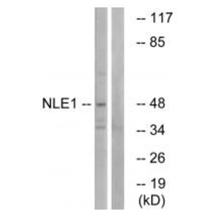 Western blot - NLE1 Antibody from Signalway Antibody (34866) - Antibodies.com