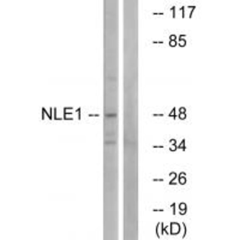 Western blot - NLE1 Antibody from Signalway Antibody (34866) - Antibodies.com