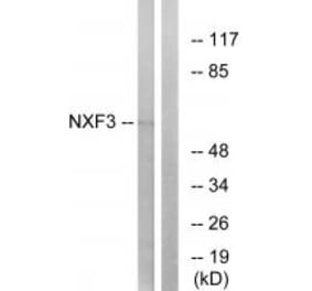 Western blot - NXF3 Antibody from Signalway Antibody (34872) - Antibodies.com