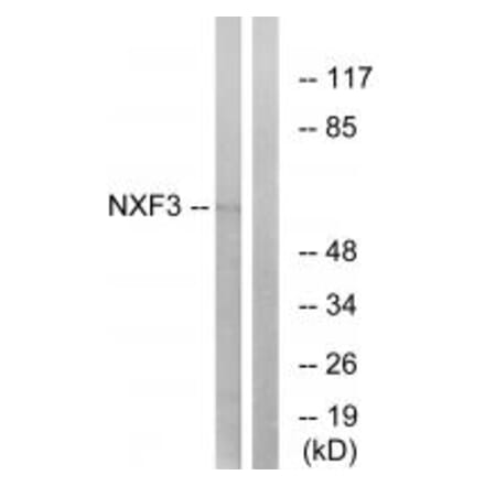 Western blot - NXF3 Antibody from Signalway Antibody (34872) - Antibodies.com