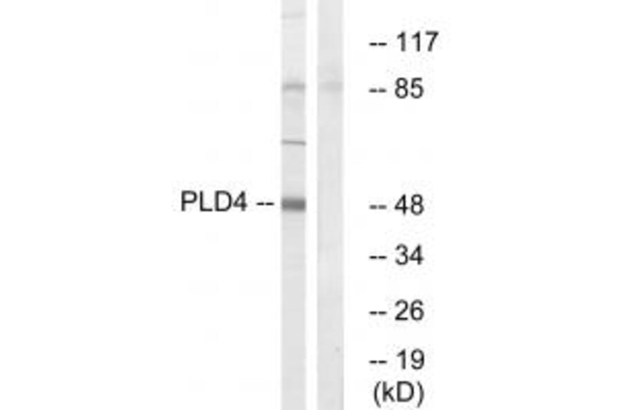 Western blot - PLD4 Antibody from Signalway Antibody (34905) - Antibodies.com