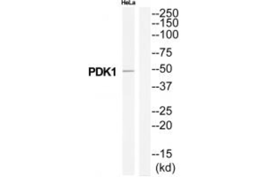 Western blot - PDK1 Antibody from Signalway Antibody (34944) - Antibodies.com