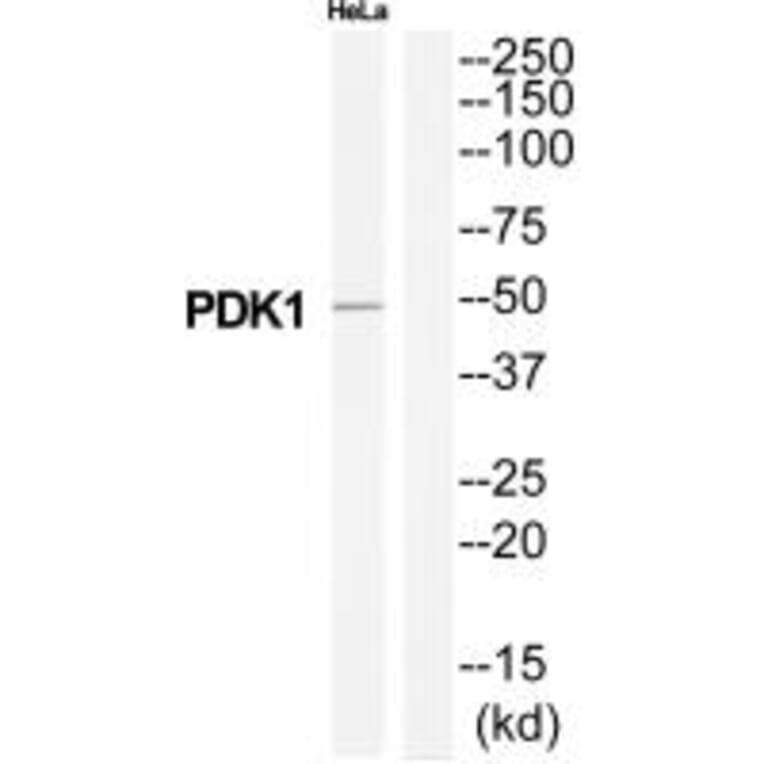 Western blot - PDK1 Antibody from Signalway Antibody (34944) - Antibodies.com