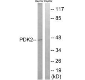 Western blot - PDK2 Antibody from Signalway Antibody (34945) - Antibodies.com