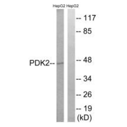 Western blot - PDK2 Antibody from Signalway Antibody (34945) - Antibodies.com