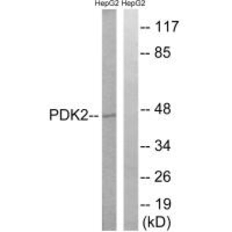 Western blot - PDK2 Antibody from Signalway Antibody (34945) - Antibodies.com