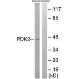 Western blot - PDK2 Antibody from Signalway Antibody (34945) - Antibodies.com