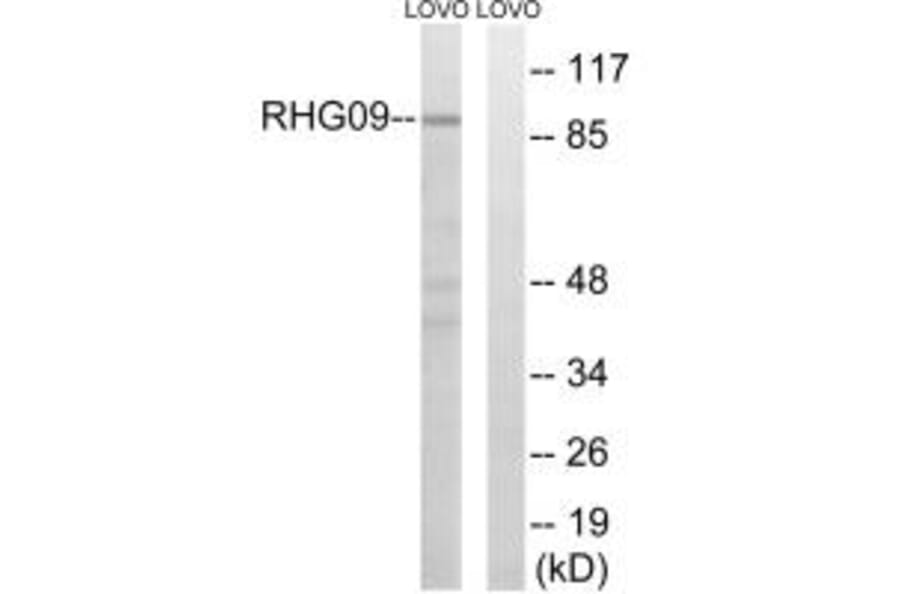 Western blot - RHG9 Antibody from Signalway Antibody (34989) - Antibodies.com