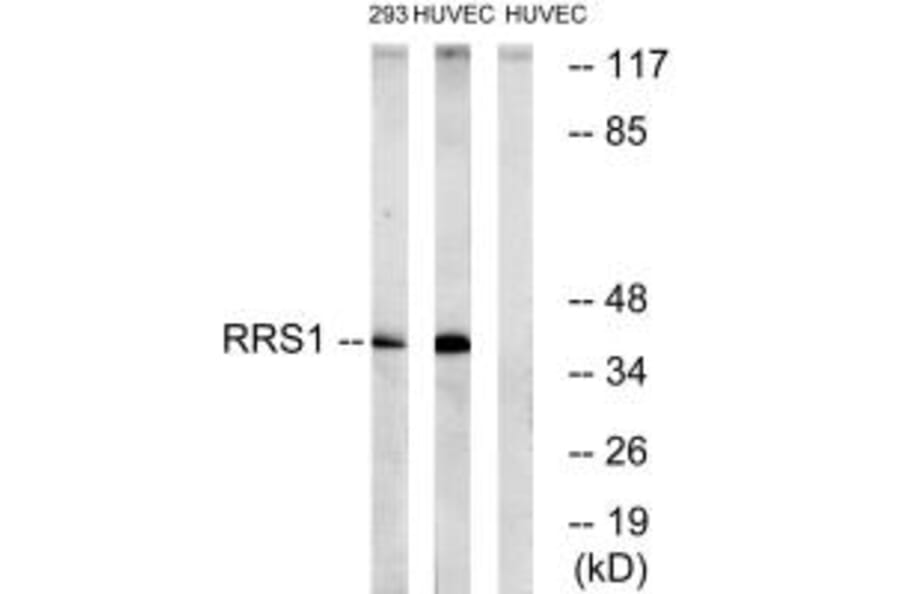 Western blot - RRS1 Antibody from Signalway Antibody (35002) - Antibodies.com