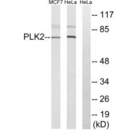 Western blot - PLK2 Antibody from Signalway Antibody (35022) - Antibodies.com