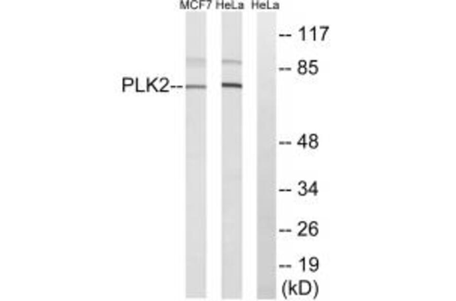 Western blot - PLK2 Antibody from Signalway Antibody (35022) - Antibodies.com
