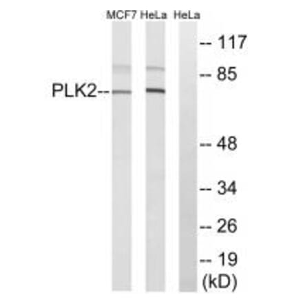 Western blot - PLK2 Antibody from Signalway Antibody (35022) - Antibodies.com