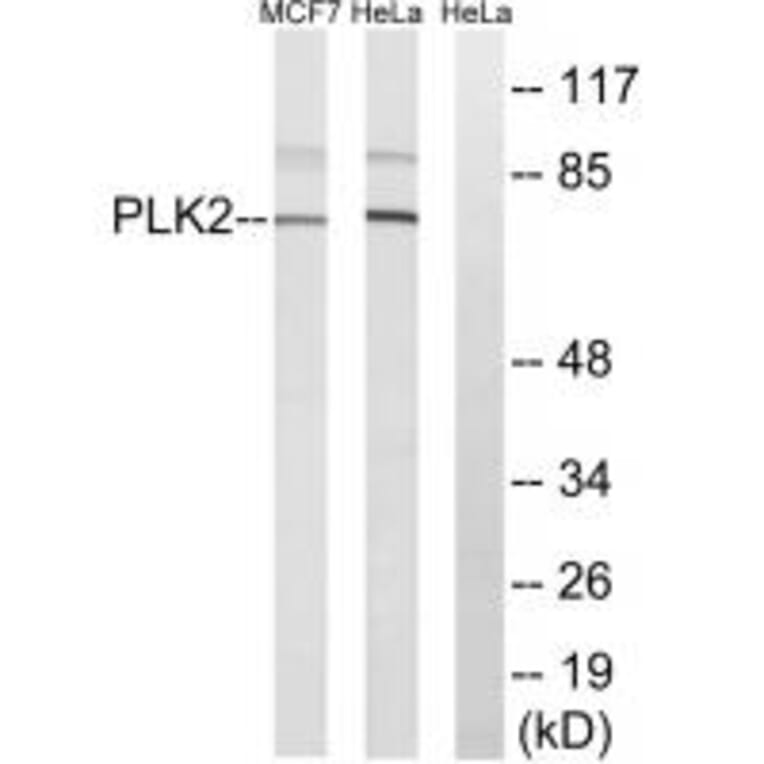 Western blot - PLK2 Antibody from Signalway Antibody (35022) - Antibodies.com