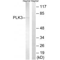 Western blot analysis of extracts from HepG2 cells, using PLK3 antibody #35023.