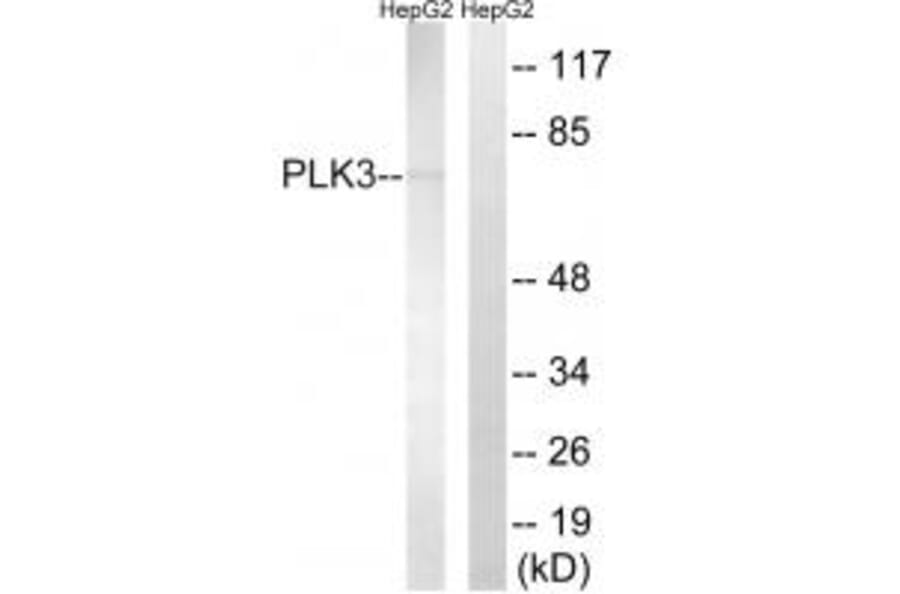 Western blot - PLK3 Antibody from Signalway Antibody (35023) - Antibodies.com