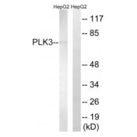 Western blot - PLK3 Antibody from Signalway Antibody (35023) - Antibodies.com